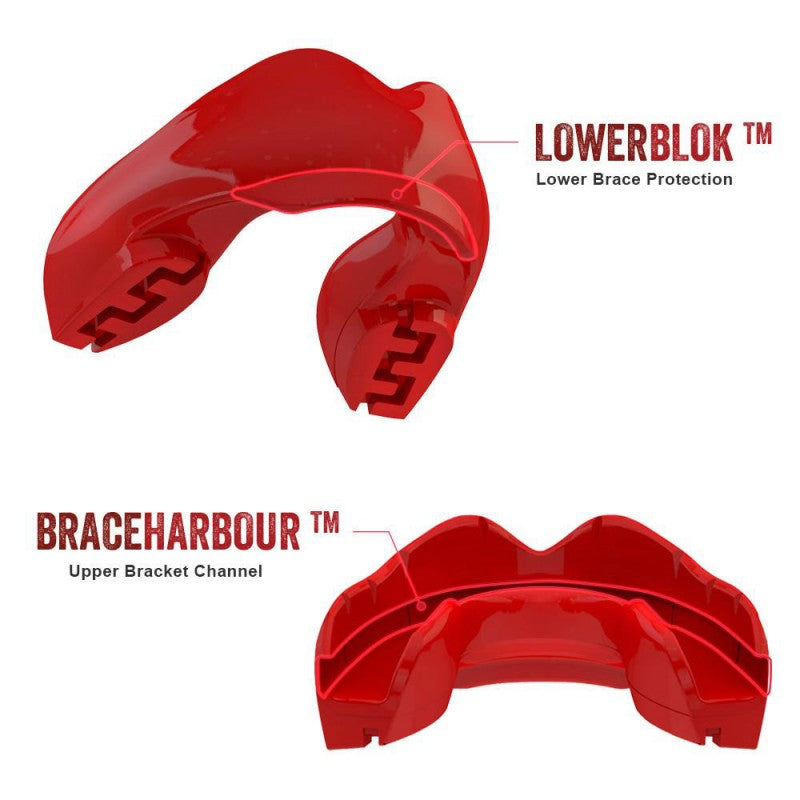 Safejawz Ortho Series Zahnspangen Zahnschutz Red