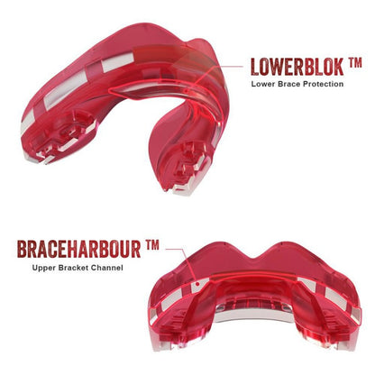 Safejawz Ortho Series Zahnspangen Zahnschutz Ice Pink
